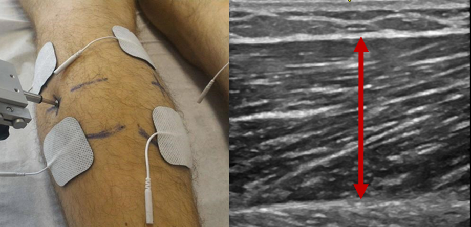 ultrasound_tmg_calf.png